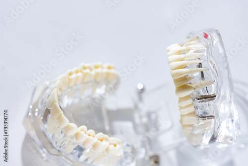 Model of human jaw. Selective Focus photo