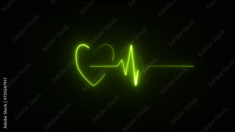 This is an electrical activity of heart. Which is demonstrated by electrocardiogram. This activity can show various type of disease of heart. This is an electrical activity of heart. Which is demonstrated by electrocardiogram. This activity can show various type of disease of heart.