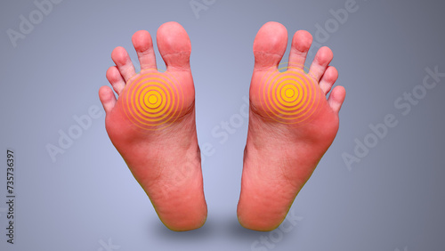 Bild auf Leinwand Foot tingling and burning feeling