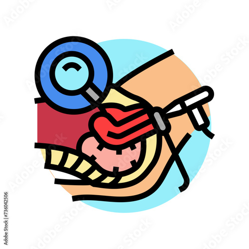 hysteroscopy surgery doctor color icon vector. hysteroscopy surgery doctor sign. isolated symbol illustration