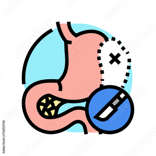 splenectomy surgery hospital color icon vector. splenectomy surgery hospital sign. isolated symbol illustration photo