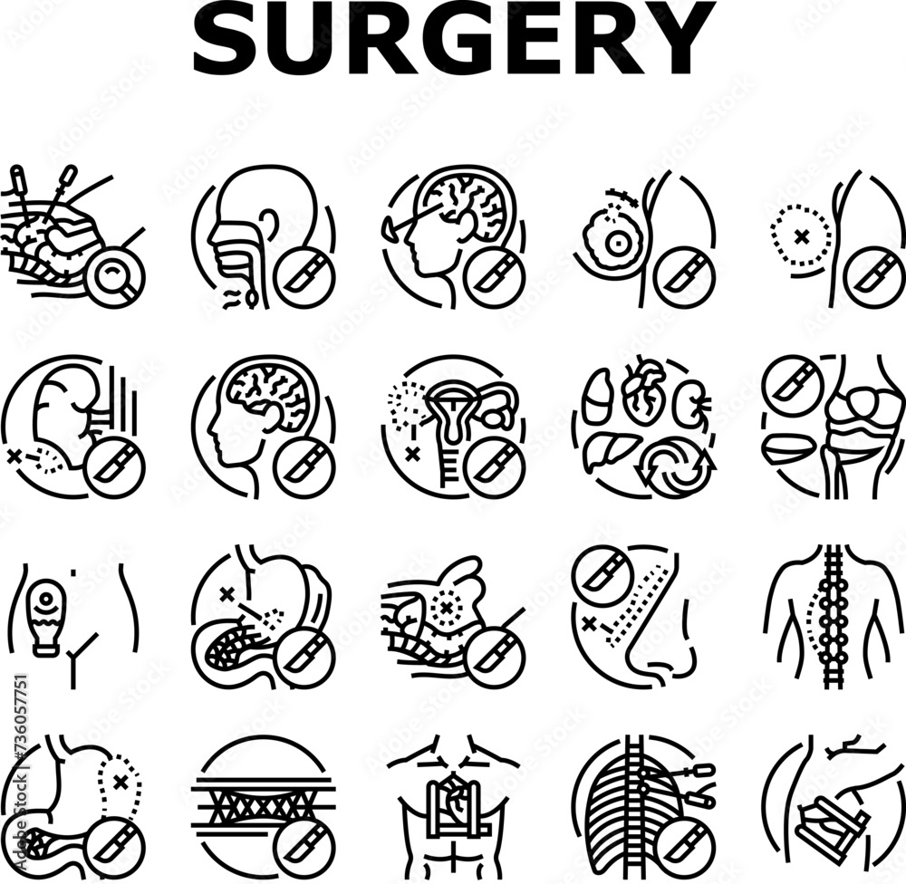 surgery hospital health icons set vector. surgical room, technology plastic, medical patient, emergency medicine, face nose surgery hospital health black contour illustrations