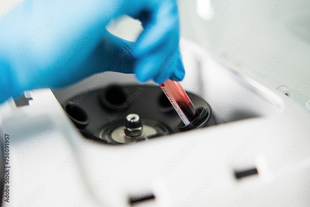A sample tube with blood tests is placed in a centrifuge with a hand in a blue rubber glove A sample tube with blood tests is placed in a centrifuge with a hand in a blue rubber glove