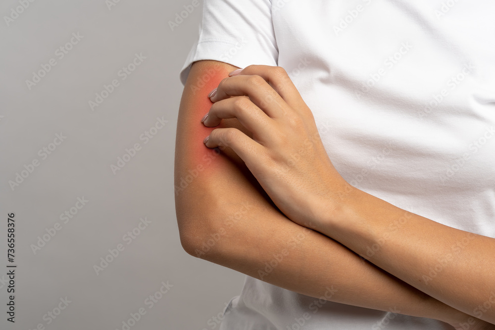 Red hand of unrecognisable person scratching painful itching skin