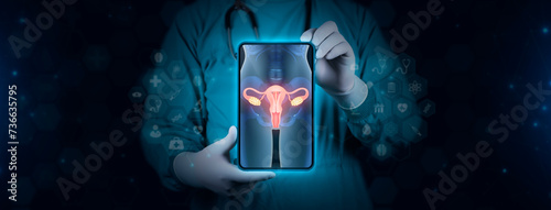 Image of a T-shaped contraceptive intrauterine device inside the uterus. The doctor studies and analyzes the IUD, its characteristics and applications inside the uterus. Contraceptive method.