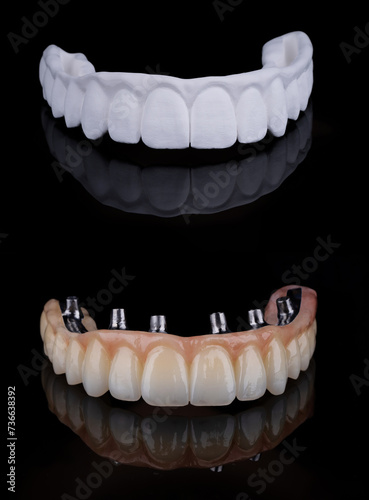Two stages of making full dental zirkonium prosthesis on titanium bar. Raw before sintering and layered or painted zirkonium.