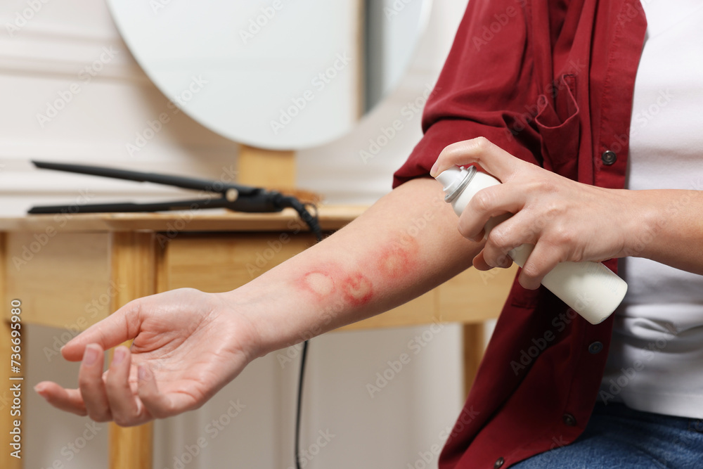 Fototapeta premium Woman applying panthenol onto burns on her hand indoors, closeup