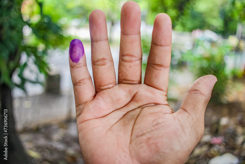 a picture of a man's hand. The ink on a man's finger was obtained after voting during the regional elections (pilkada) in Semarang, Indonesia © achmadwisaputro