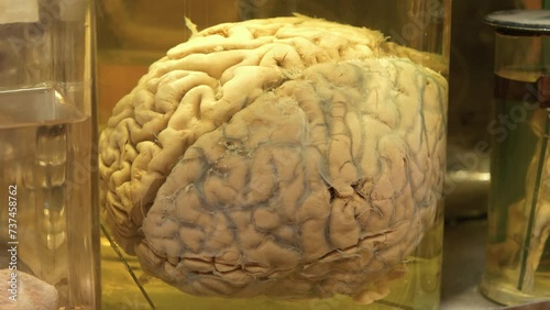 Human brain in flask. Anatomy of the brain, convolutions of brain, cerebral hemispheres, gyri of cerebrum. Human brain in glass jar with formaldehyde for medical research. Brain in a vat photo