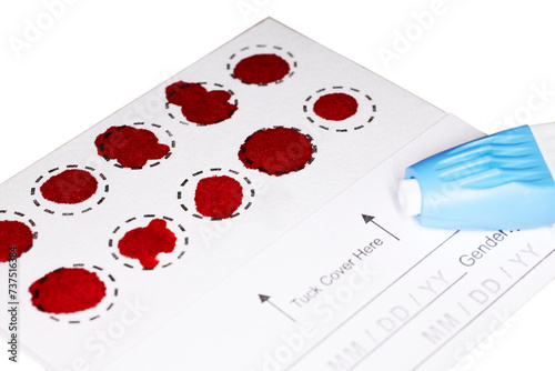 A Completed Blood Spot test card with droplets of blood for hormone testing