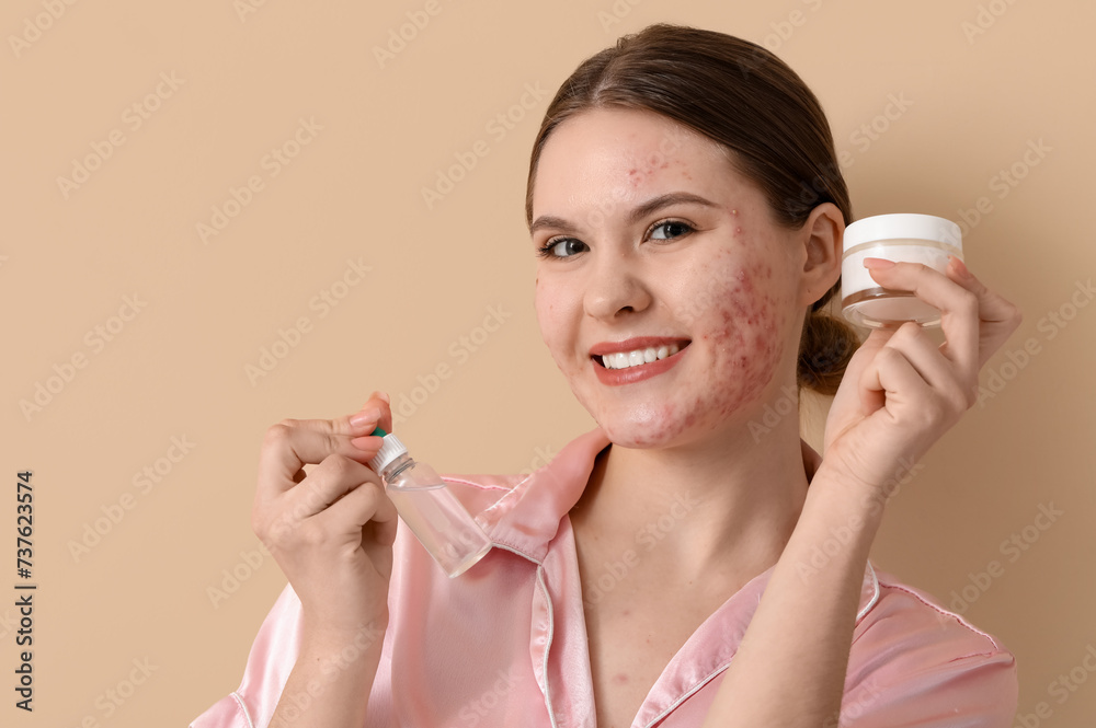 Young woman with acne problem and skincare products on beige background, closeup Young woman with acne problem and skincare products on beige background, closeup