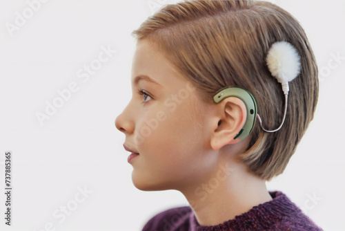 Teen girl with blond hair wearing cochlear implant cover of a fluffy hairpin.