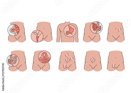 Hernias line icons set. Vector isolated element. photo