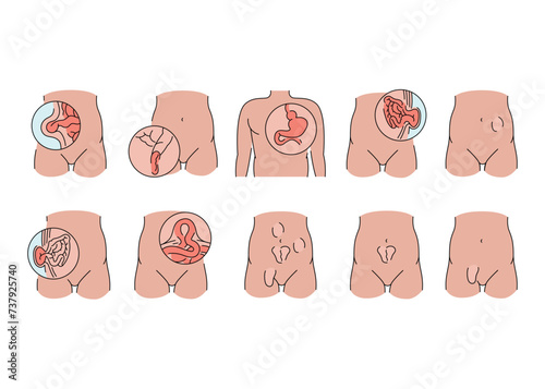 Hernias line icons set. Vector isolated element.