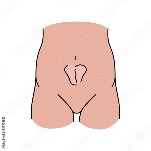 Incisional hernia line icon. Vector isolated element.