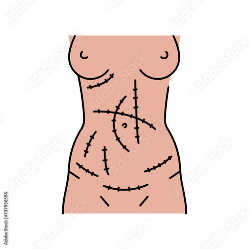 Abdominal incisions line icon.