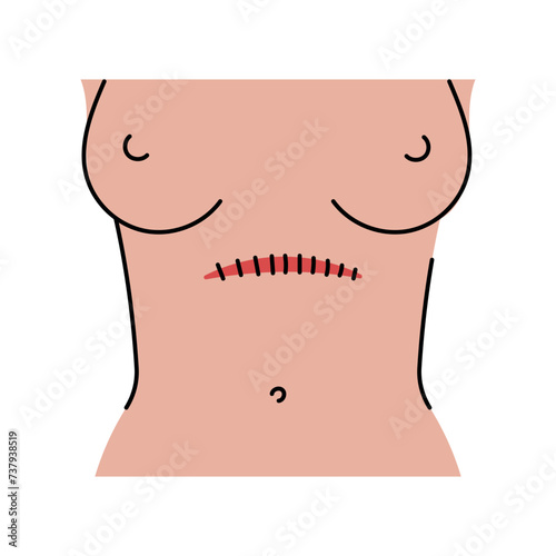 Transverse incision line icon. Abdominal incisions.