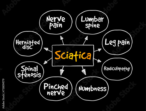 Sciatica - pain, weakness, numbness, or tingling in the leg, mind map text concept background