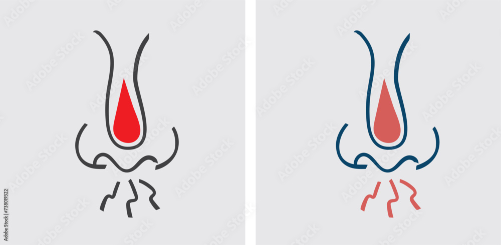 Nosebleeds (Epistaxis) is bleeding from the nose, often caused by dry ...