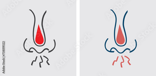 Nosebleeds (Epistaxis) is bleeding from the nose, often caused by dry air, nasal trauma, allergies, or underlying medical conditions such as high blood pressure