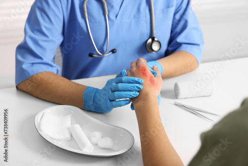 Doctor examining patient's burned hand at table, closeup