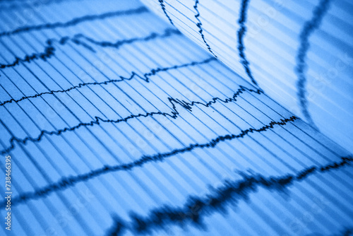 Photos Sinus Heart Rhythm On Electrocardiogram Record Paper Showing Normal P Wave, PR a