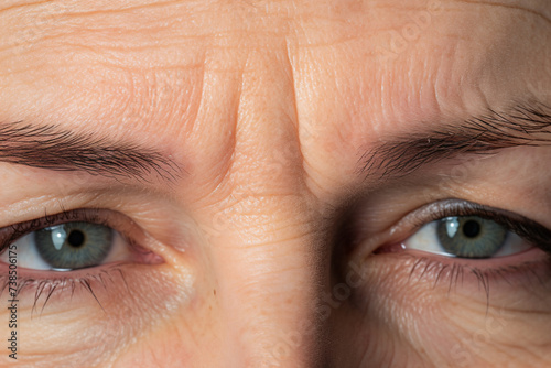 Woman's frown line wrinkles between eyebrows
