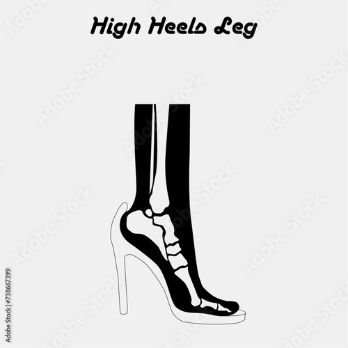 high heels, Symptom pain on foot because wearing high heels make heel bone damage and muscles, Deformation of the foot bones,high heeled shoes structure vertebral column diagram hand drawn schematic