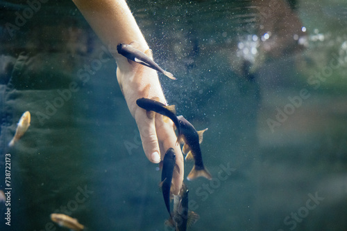 R  tliche Saugbarbe  Doctor Fish