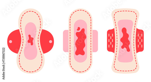 Set of pads with blood. Heavy and light menstrual period. Bleeding menstrual period on sanitary napkins. 