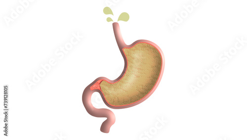 Stomach heartburn sign, color flat illustration