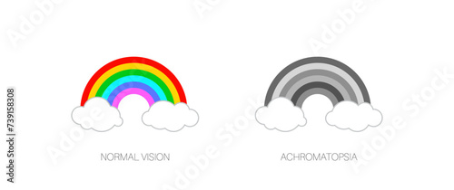 Achromatopsia vision deficiency photo