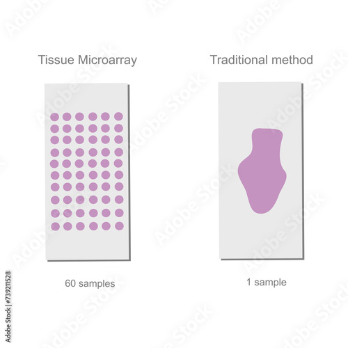 The technique comparison between Traditional method and Tissue microarray (TMA) for target detection in pathology principle.