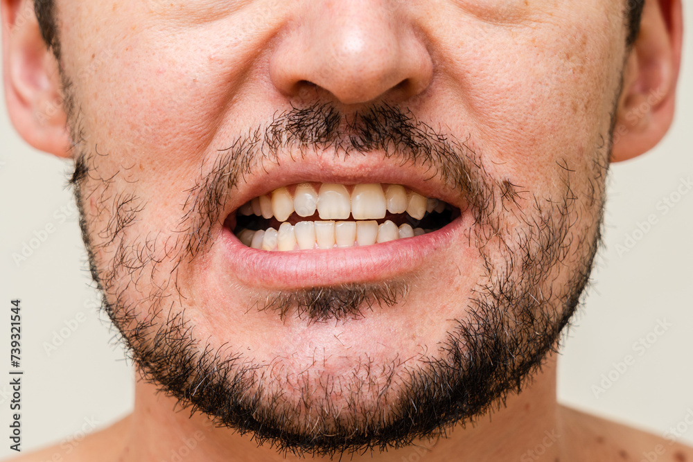 Closeup young man with beautiful smile. Teeth whitening, teeth straightening, fresh breath Closeup young man with beautiful smile. Teeth whitening, teeth straightening, fresh breath