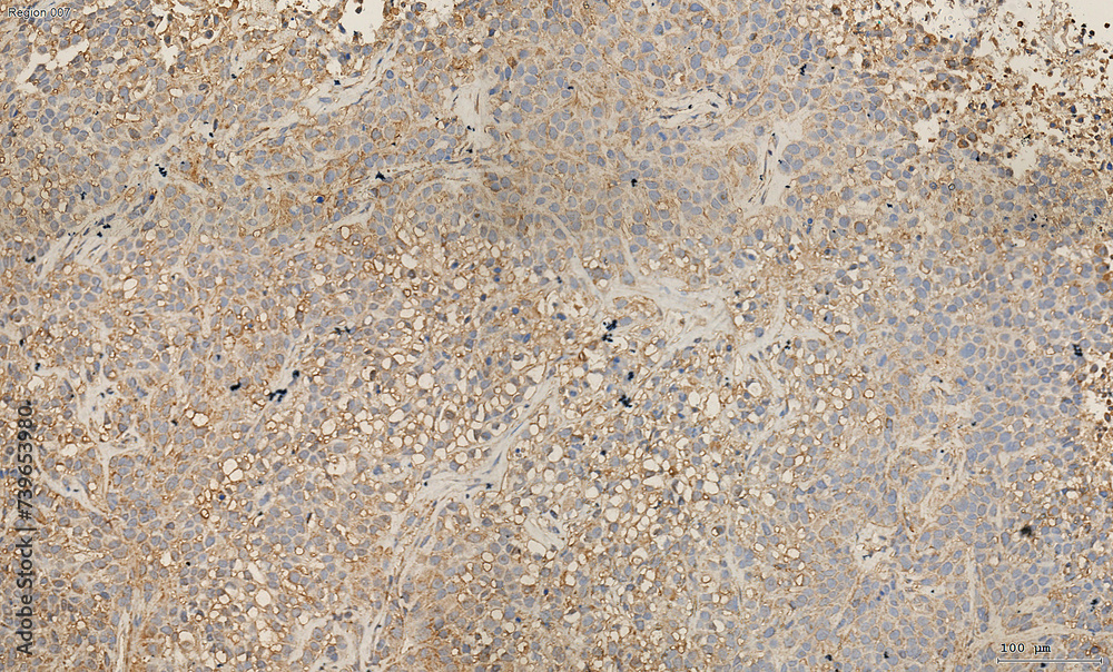 Immunohistochemistry Staining in Histopathology Immunohistochemistry Staining in Histopathology