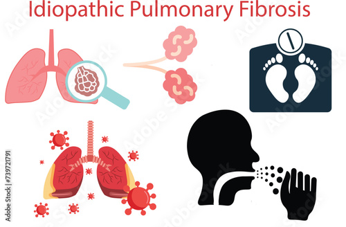 Idiopathic pulmonary fibrosis,shortness of breath,persistent dry cough,
tiredness,weight loss,pillary dry cough of wood metal dust breath virus,five vectors