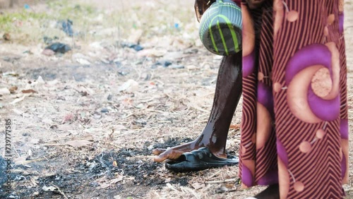 9 jan. 2024,Gwalada,Nigeria: close up of Malnourished child due to extreme poverty, hunger, drought and climate change in Nigeria Africa . Rural Black African children Poor living conditions.