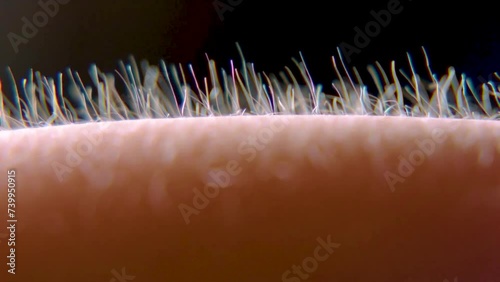 Goosebumps Hair on his hand stand up. Static electricity.