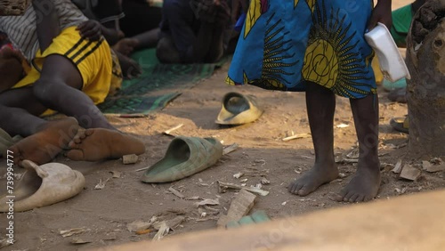 9 jan. 2024,Gwalada,Nigeria: Malnourished child due to extreme poverty, hunger, drought and climate change in Nigeria Africa . Rural African children Poor living conditions.poverty hunger in Africa