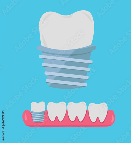 Tooth, teeth, implant, dental vector illustration set
