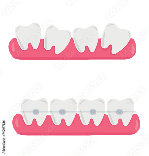 Tooth, teeth, implant, dental vector illustration set
