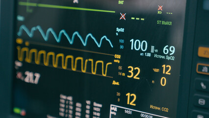 Medical equipment in hospital modern heart rate monitor in operating room display for monitoring patient vital signs anesthesia indicators on screen computer in professional healthcare clinic surgery