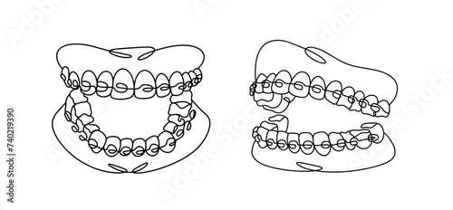 Jaw. Braces. Teeth. Dentistry