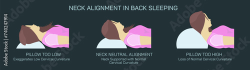 Text Neck Syndrome of phone posture is the onset of cervical spinal degeneration from excess look down at mobile screens. Aka Anterior head prevention. Cervical neck aches vector illustration.  photo