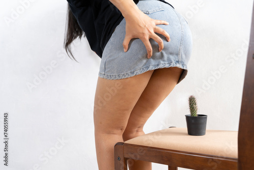 Woman suffering from hemorrhoids and cactus thorns on a chair. Woman suffering from hemorrhoids. photo