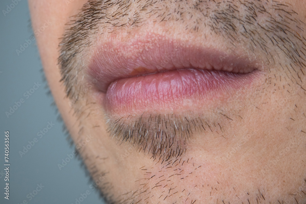 Caucasian male with uneven stubble, unshaven, close up shot, unrecognizable, no eyes Caucasian male with uneven stubble, unshaven, close up shot, unrecognizable, no eyes