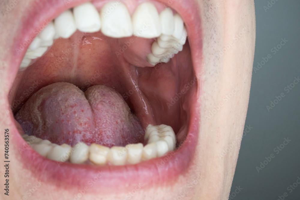 Obraz premium Caucasian male open oral cavity, close up shot