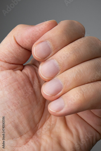 Caucasian male fingers, closed or clutched hand, close up shot, fingernails.