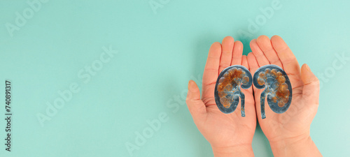 Kidney organ disease, world kidney day, health problems, donation and transplantation, medical issue
 photo