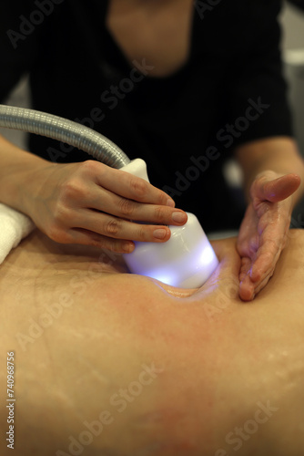 profesional de la belleza aplicando a una paciente sesión de tratamiento de piel y grasas photo
